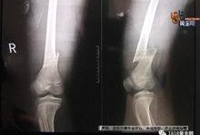 骨头男孩在线观看,奇幻冒险之旅在线观看攻略