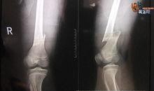 骨头男孩在线观看,奇幻冒险之旅在线观看攻略